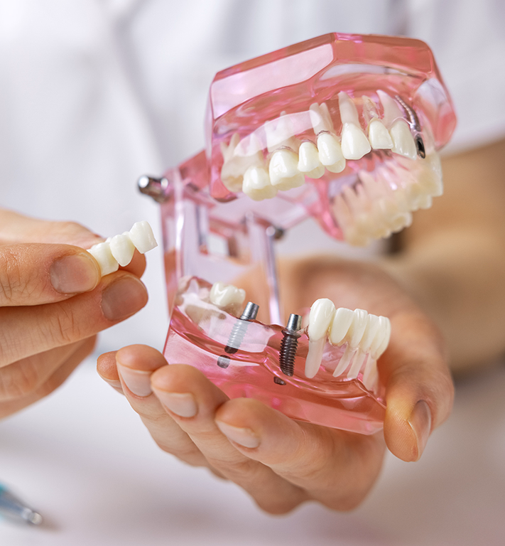 Eslotus Clinics - Gülüşünüze Sanatsal Bir Dokunuş